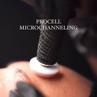 Procell Microchanneling package (3) at Esthetics by Dayana in Topeka, KS